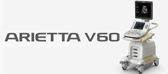 ARIETTA v60